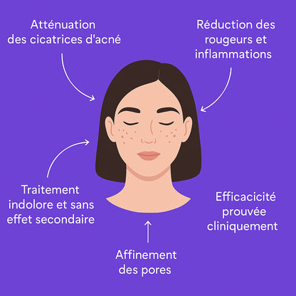 Masque LED Visage - Soin Lumière Anti-Rides & Peau Éclatante - skymoons